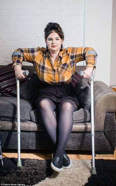 22-летнюю девушку из США почти парализовало при родах